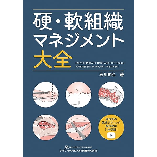 シングル・トゥースインプラント: 前歯部および臼歯部抜歯窩に対する低 