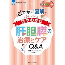 肝胆膵の治療とケアQ&A: どでかい図解でカンタンスイスイはやわかり