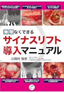 サイナスフロアエレベーションアルティメットガイド: 安全確実に上顎洞