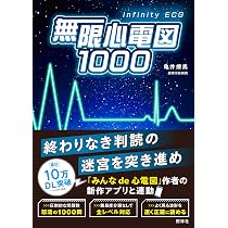 心電図判読大全 | 藤澤友輝 |本 | 通販 | Amazon