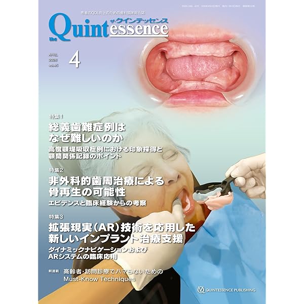 裁断済み　ノンメタルクラスプデンチャー　増補新版 ノンメタルクラスプデンチャー 増補新版: 長く使える設計の原則から