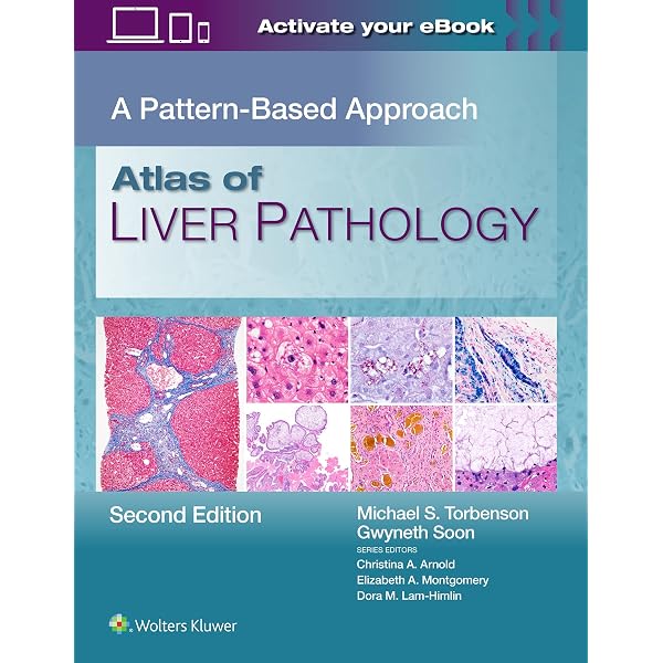 Amazon | MacSween's Pathology of the Liver | Burt BSc MBChB MD