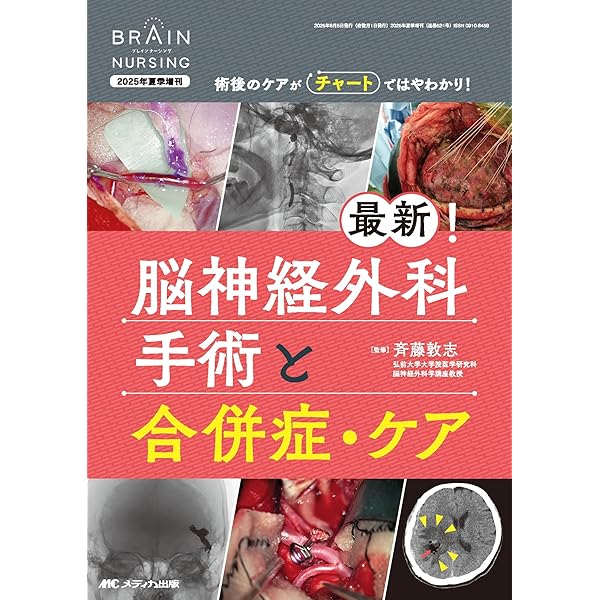 脳神経外科の手術看護パーフェクトマニュアル: 解剖から主要手術の看護