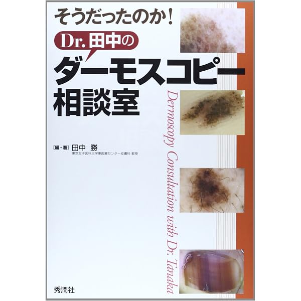 Amazon.co.jp: ダーモスコピーのすべて(改訂第2版) : 斎田俊明, 宇原