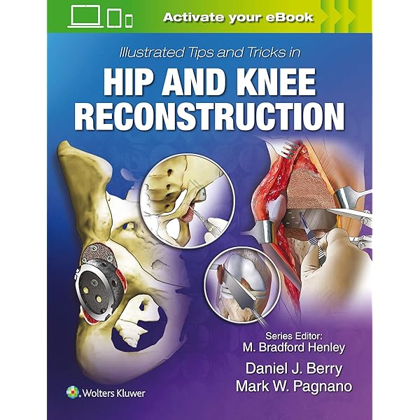 Amazon | The Adult Hip (Two Volume Set): Hip Arthroplasty Surgery 