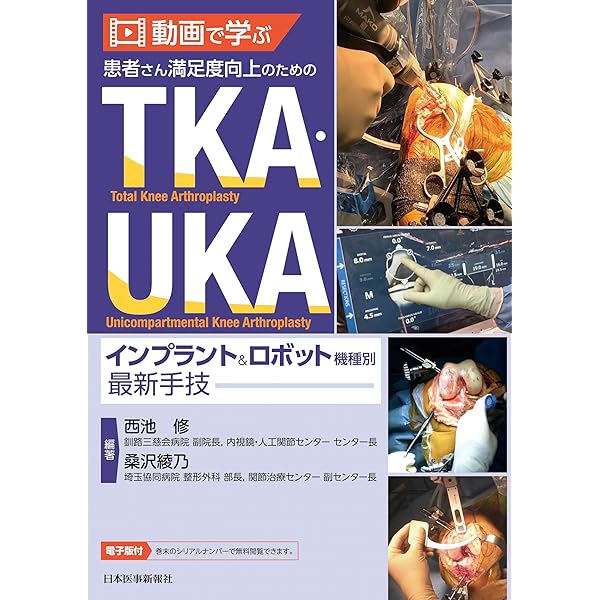 ＴＫＡ／ＵＫＡの匠　思考と技巧 - Ｗｅｂ動画付 TKA/UKAの匠【Web動画付】: 思考と技巧 | 平中崇文, 浜口英寿