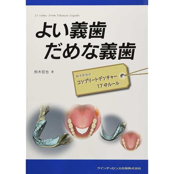 Amazon.co.jp: コンプリートデンチャー: ランクアップのための知恵と技 