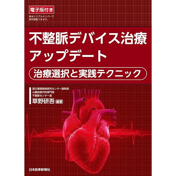 EPS: 臨床心臓電気生理検査 | 井上 博 |本 | 通販 | Amazon