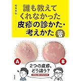 誰も教えてくれなかった皮疹の診かた・考えかた[Web動画付]