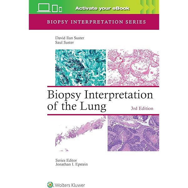 Amazon | Diagnostic Histopathology of Tumors, 2 Volume Set