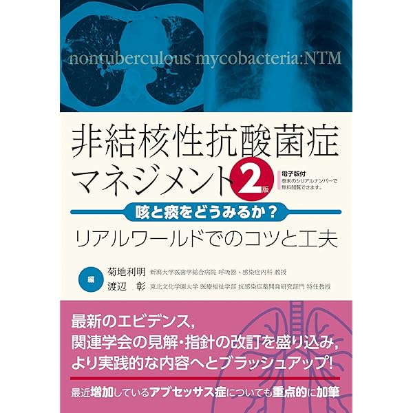 非結核性抗酸菌症診療 Up to Date | 倉島篤⾏, ⼩川賢⼆, 森本耕三