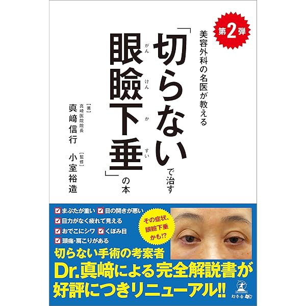 眼瞼下垂/メディカル葵出版/マイケル・キャラハン（単行本） 眼瞼下垂/メディカル葵出版/マイケル・キャラハン（単行本）