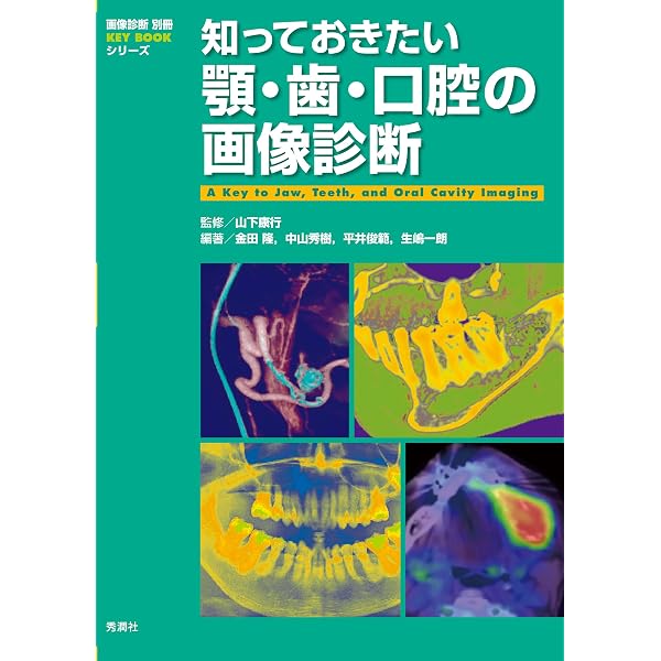 Amazon.co.jp: 知っておきたい乳房の画像診断 (画像診断別冊KEYBOOK