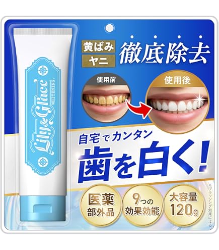 Amazon | ホワイトニング V34 ジェル 歯磨き粉 | SUNSHINE SMILE