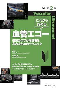 血管超音波テキスト 第2版 | 日本超音波検査学会, 佐藤 洋 |本 | 通販