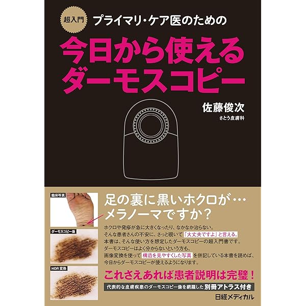 【裁断済】ダーモスコピーのすべて 第2版 Amazon.co.jp: ダーモスコピーのすべて(改訂第2版) : 斎田俊明