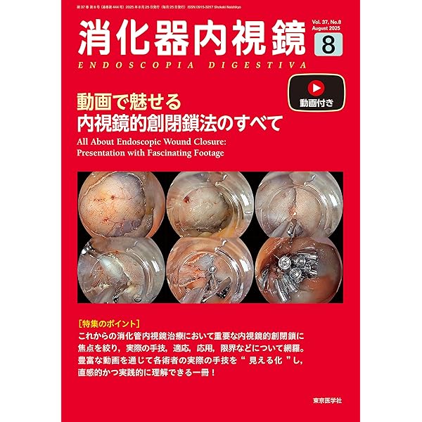 Amazon.co.jp: 十二指腸腫瘍の内視鏡治療とマネジメント : 小山