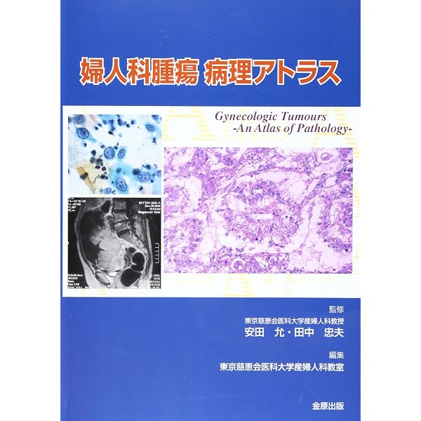 婦人科病理診断トレ-ニング: What is your diagnosis? | 清水 道夫 |本