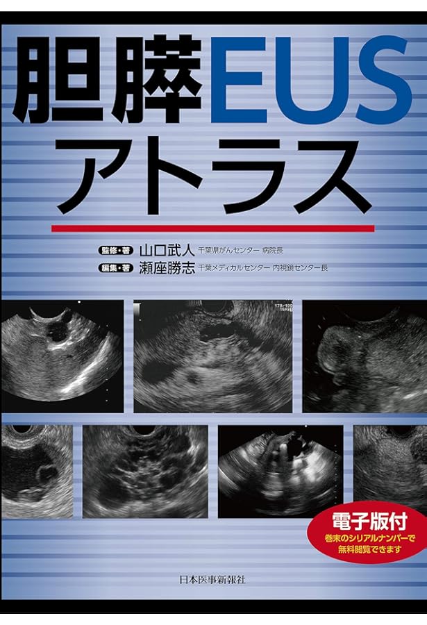 胆膵EUSセミナー〜CT・シェーマ・動画と合わせてわかる手技の基本から