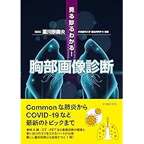 見る診るわかる! 胸部画像診断 | 瀧川 奈義夫 |本 | 通販 | Amazon
