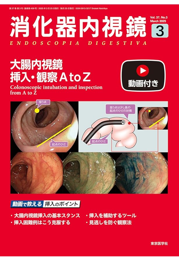 大腸内視鏡挿入法 腸にやさしい大腸内視鏡挿入法 |本 | 通販 | Amazon
