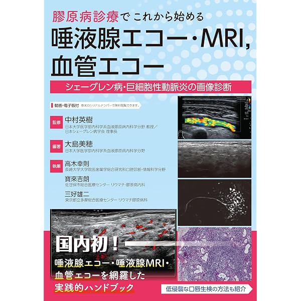リウマチ診療のための筋骨格超音波検査 ―実践ガイド ― | 中込大樹