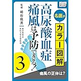 名医がカラー図解! 高尿酸血症・痛風は予防できる! (3) 痛風の正体は？ (impress QuickBooks)