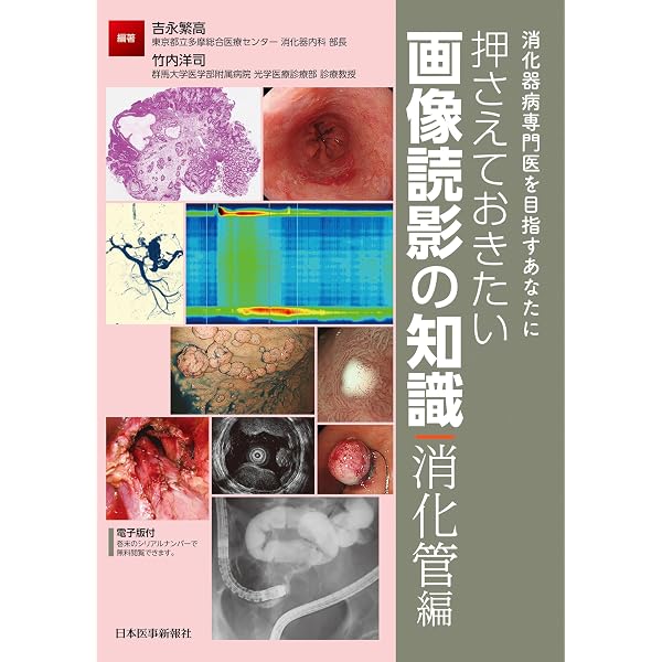 消化器病専門医を目指すあなたに 押さえておきたい画像読影の知識