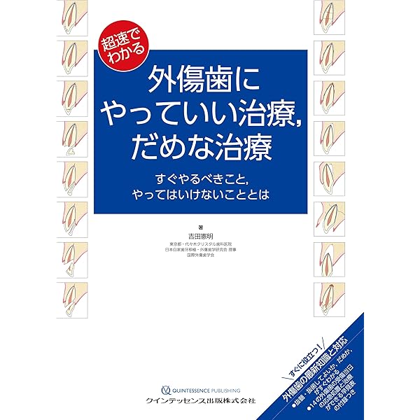 Amazon.co.jp: 外傷歯の診断と治療 増補新版 (シリーズ MIに基づく歯科