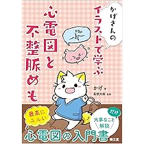 絵『心電図』 心電図(jpg・CSeps）：イラスト無料