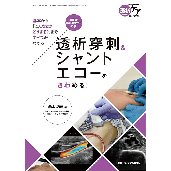 エコーを使ったバスキュラーアクセス穿刺法ガイド | 木船 和弥, 木船