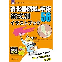 Amazon.co.jp: 消化器領域の手術56 術式別イラストブック:手術操作で Amazon.co.jp: 消化器領域の手術56 術式別イラストブック:手術操作で