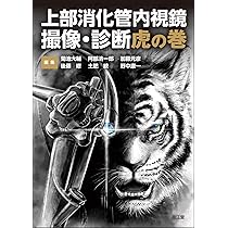 上部消化管内視鏡 撮像・診断虎の巻 | 菊池大輔, 阿部清一郎, 加藤元彦 上部消化管内視鏡 撮像・診断虎の巻 | 菊池大輔, 阿部清一郎, 加藤元彦