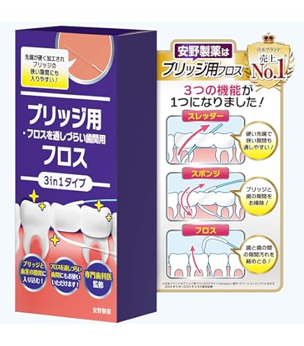 Amazon | 100本入 スーパーフロス ブリッジ用 オールマイティフロス