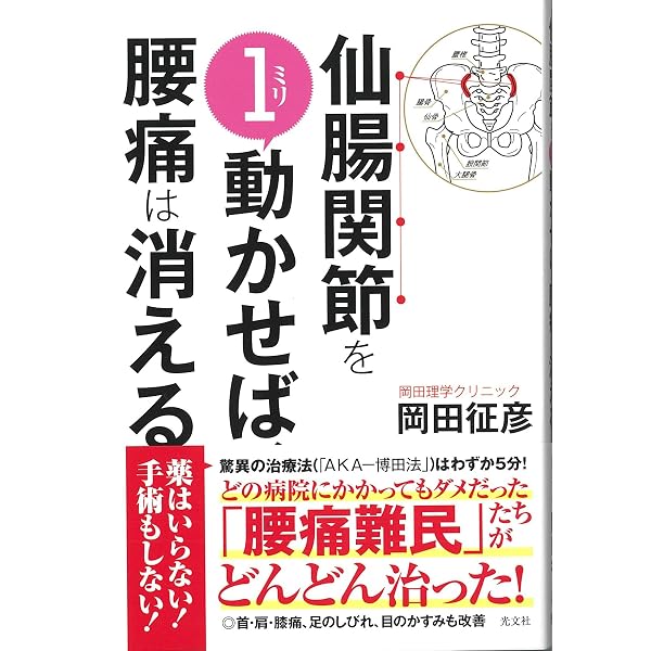 Amazon.co.jp: 改訂版! 病院では治せない 仙腸関節炎 : 吉岡 美奈: 本