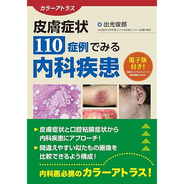 あたらしい皮膚病診療アトラス | 清水 宏 |本 | 通販 | Amazon