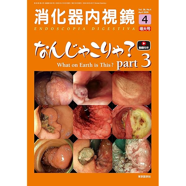 消化器内視鏡37巻3号2025年3月号 大腸内視鏡 挿入・観察A to Z