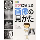 ケアに使える画像の見かた: X線写真・CT画像・エコ-像・MRI