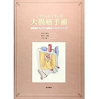 絹笠式TMDU大腸癌手術[Web動画付] | 絹笠祐介 |本 | 通販 | Amazon