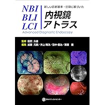 新訂NBI内視鏡アトラス 新訂NBI内視鏡アトラス | 武藤学, 八尾建史, 佐野寧 |本 | 通販