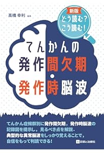 臨床脳波学 第6版 | 大熊 輝雄 |本 | 通販 | Amazon