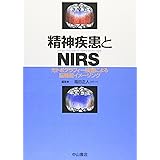 光トポグラフィー検査ガイドブックーnirs波形の臨床判読 福田正人 西村幸香 本 通販 Amazon