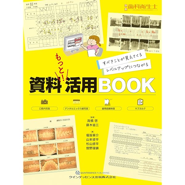 歯ブラシ処方箋　別冊歯科衛生士　クインテッセンス出版 歯ブラシ処方箋2: 歯ブラシ選びでブラッシングが変わる (別冊歯科衛生