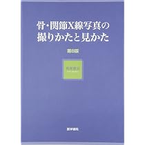 91fEKq3iDSL._AC_UL210_SR210,