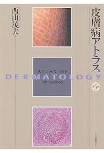 あたらしい皮膚病診療アトラス | 清水 宏 |本 | 通販 | Amazon
