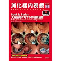 消化器内視鏡38巻3号2026年3月号 Back to Basics大腸腫瘍に対する内視