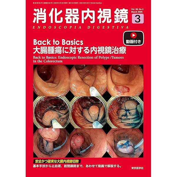 消化器内視鏡37巻11号2025年11月号 直腸肛門病変の診断と治療 | 「消化