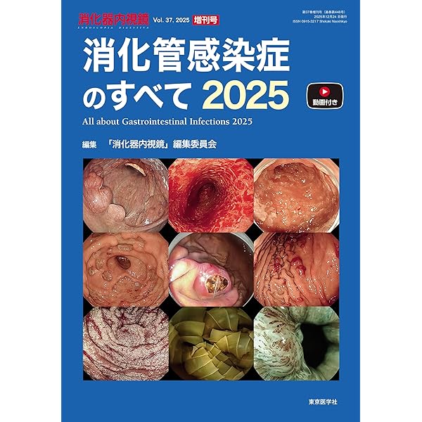 消化器内視鏡36巻7号2024年7月号 消化管粘膜下腫瘍のすべて | 「消化器