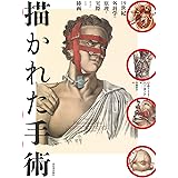 描かれた手術 (Wellcome collection)