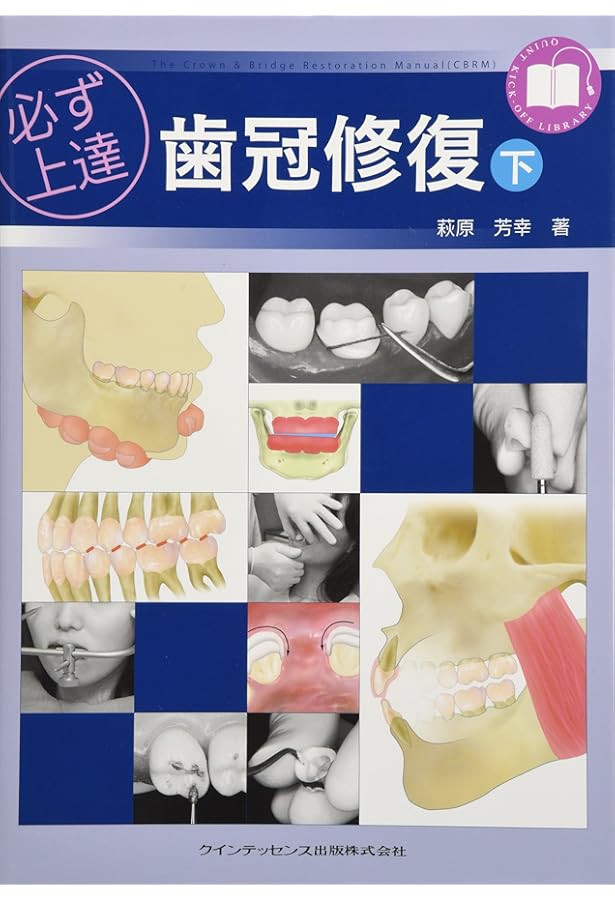 必ず上達 デジタル時代の歯冠修復 | 萩原芳幸 |本 | 通販 | Amazon